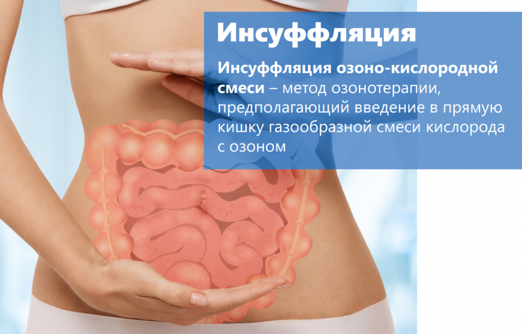 инсуфляция озоном с текстом.jpg