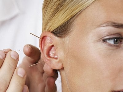 Рефлексотерапия